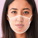 آیا استفاده از ماسک باعث ایجاد آکنه میشود؟