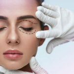 درمان افتادگی پلک