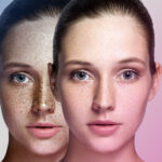 عوامل تخریب مستقیم پوست