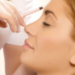 مزایا و عوارض تزریق فیلرهای هیالورونیک اسید