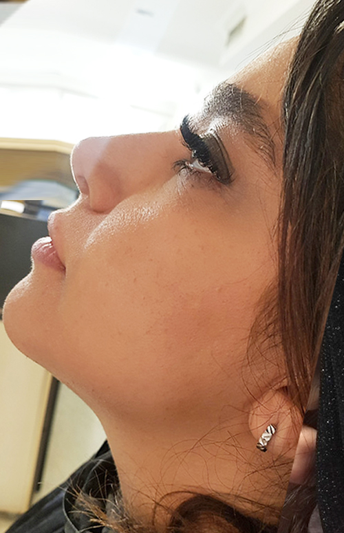 بعد از اسکارلت