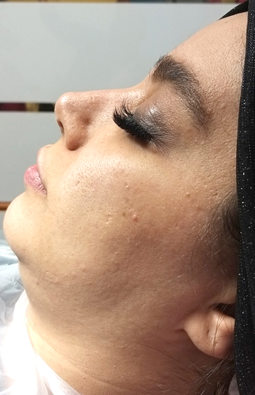 قبل از اسکارلت