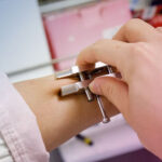 راهکار جدید دارورسانی به بدن از طریق پوست