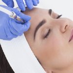 همه چیز درباره میکرودرم ابریژن