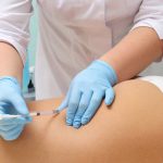 مزوتراپی چگونه باعث لاغری میشود؟